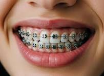 Dental Clinic Bhimavaram