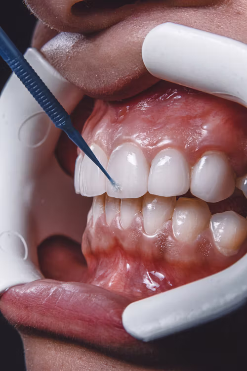Dental Clinic Bhimavaram 